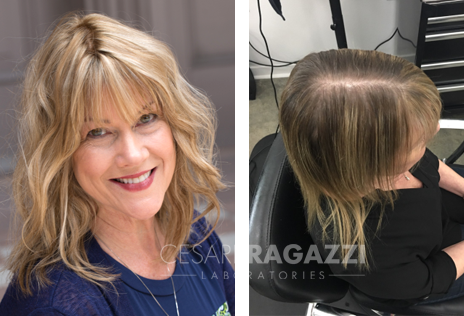 Cesare Ragazzi Hair Replacement for Women - Profiles by Kristin Hair  Replacement Syracuse NY