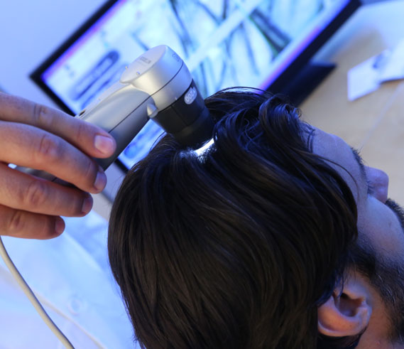 hair-loss-treatment-restoration-syracuse-ny hair loss treatment restoration syracuse ny