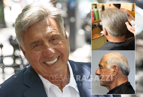 non-surgical hair replacement for men - syracuse new york