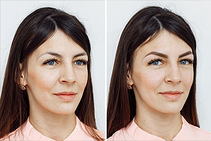 Microblading Before / After
