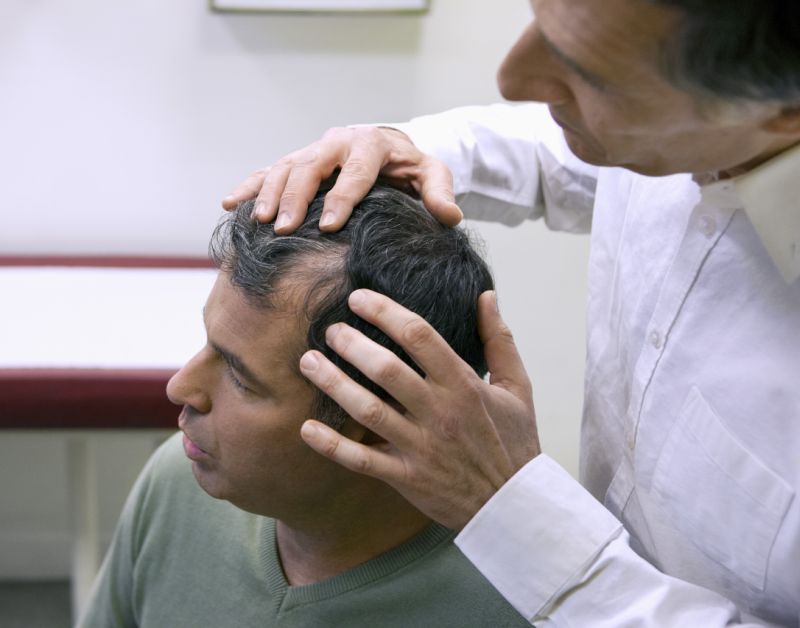 Syracuse hair transplant vs Hair Replacement Central New York Onondaga County